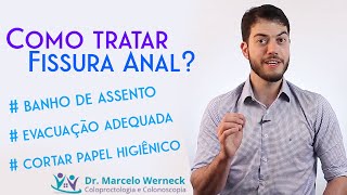 Como tratar fissura anal [upl. by Nauquf]