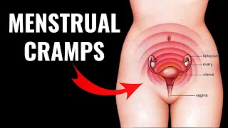 Menstrual cramps  Dysmenorrhea [upl. by Newmann728]