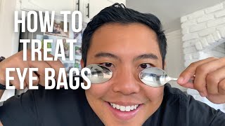 How to get rid of UNDER EYE BAGS FAST the SAFEST ways  👁 Ophthalmologist michaelchuamd [upl. by Aniale42]