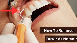 Is it Possible To Remove Tartar At Home [upl. by Ayhay]