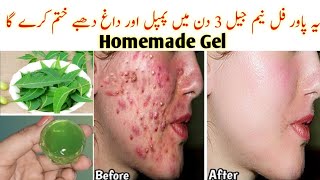 I applied👆🏻this DIY Neem Gel on Acne Pimples PigmentationBumps  Got Clear Glowing Skin In 3 Days [upl. by Engeddi]