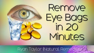 How To Remove Eye Bags 20 Minute Natural Remedies [upl. by Elman]