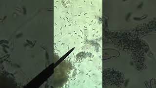 paramecium worms king of paramecium worms microscope [upl. by Noskcaj]