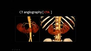 08 Urinary Tract Imaging 2 Dr Mamdouh Mahfouz [upl. by Aicnatsnoc927]