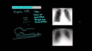 Types of Chest XRays part 2  Lateral Supine Decubitus UndergroundMed [upl. by Peck]