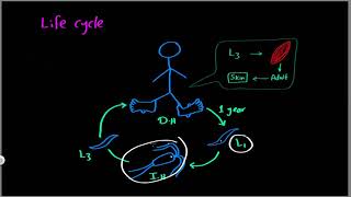 Parasitology 15 Dracunculus »DrMoaz [upl. by Rocray]