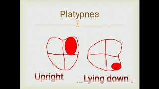 Platypnea or Orthodeoxia [upl. by Bevis]