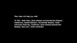 Dental foci Dental infection Toothache etc Isochronic Tones 475 Hz Pure Series [upl. by Ahk762]