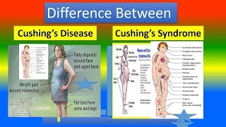 Difference Between Cushing’s Disease and Cushing’s Syndrome [upl. by Scharaga703]