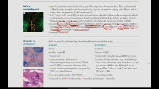 Listeria Monocytogenes Nocardia vs Actinomyces  Microbiology  13  First Aid USMLE in UrduHindi [upl. by Echikson]