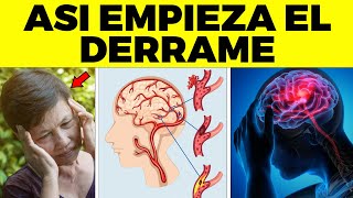 Así Empieza El Derrame Cerebral En Una Mujer  Signos Y Síntomas de Derrame Que Debes Conocer [upl. by Airotkiv]