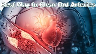 The Best Way to Clear Out Clogged Arteries [upl. by Devlen]