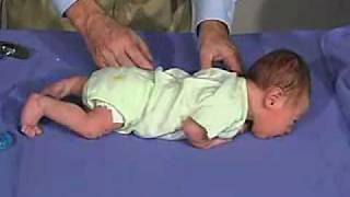 physical exam Newborn Normal Positions  Prone [upl. by Bridget]