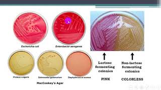 Pathogenic bacteria Lab1 Lab diagnostic tests [upl. by Eellac722]