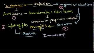 Listeria monocytogenes infection [upl. by Outlaw]