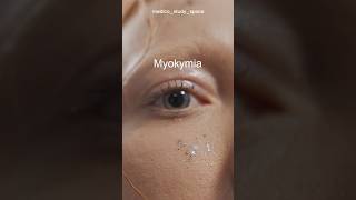 Uncover the truth behind eyelid twitches Myokymia eyes eyehealth wellness shorts [upl. by Muhan377]