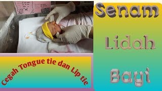 Senam lidah bayi cegah tongue tie dan lip tie  agar bayi lancar menyusui [upl. by Cathleen]