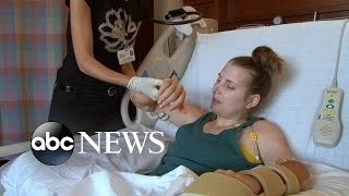 Lindsay Ess Story Part 1 Quadruple Amputee Undergoes Double Hand Transplant Surgery [upl. by Dorfman]