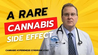 Cannabis Hyperemesis Syndrome or CHS [upl. by Cherida882]