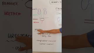 Urostomy nursingskills nursingstudent nursing [upl. by Assenahs]