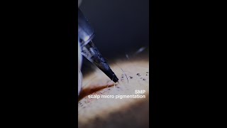 Scalp Micro Pigmentation SMP Non Permanent Tattoo Artificial Hair [upl. by Karab]