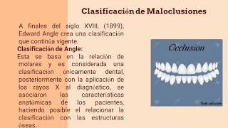 Video maloclusiones defectos dentales [upl. by Allemaj583]