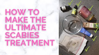 How To Make The Ultimate Scabies Treatment At Home That Works [upl. by Novel]