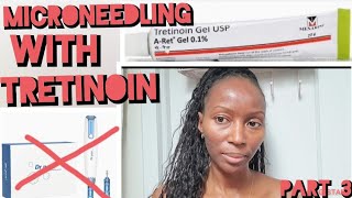 MICRONEEDLING WITH TRETINOIN WITHOUT DRPEN PART 3 [upl. by Rockwell290]