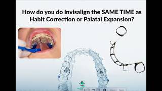 How do you do Invisalign Treatment SAME TIME as Habit Correction or Palatal Expansion [upl. by Ynittirb12]