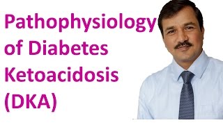 Diabetes Ketoacidosis DKA  Pathophysiology [upl. by Alvarez]