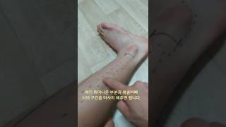 비골근 근막이완 Fibularis Longus Brevis SMR [upl. by Narad786]