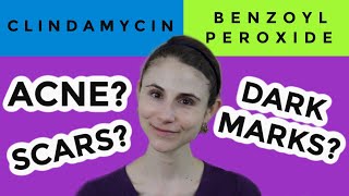 Clindamycin versus benzoyl peroxide for acne Dr Dray [upl. by Olrak924]