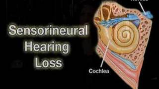 Understanding the Hearing Impaired Helping 4 [upl. by Bobbye]