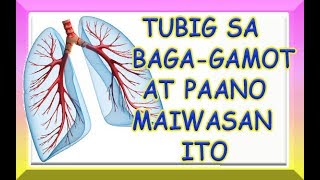 TUBIG SA BAGA PULMONARY EDEMA  GAMOT AT PAANO MAIWASAN [upl. by Ykceb534]