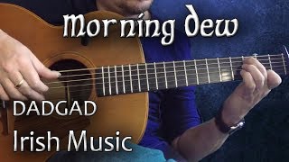 Morning Dew  Irish Guitar  DADGAD Fingerstyle Reel [upl. by Abercromby740]