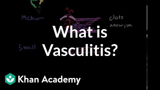 What is vasculitis  Circulatory System and Disease  NCLEXRN  Khan Academy [upl. by Suinuj]