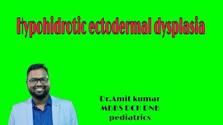 Hypohidrotic ectodermal dysplasia [upl. by Beyer]