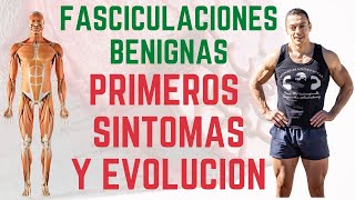 Fasciculaciones Benignas Primeros Síntomas y Evolución [upl. by Otrebogir]