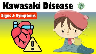 Kawasaki Disease  Signs amp Symptoms What Are The Major Signs amp Symptoms Of Kawasaki Disease [upl. by Yezdnil]