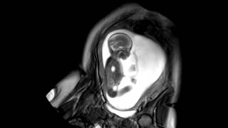 Foetal Development Unborn Baby Movement at 24 Weeks  WIRED [upl. by Aloke961]