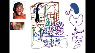 Mycobacterium Leprae [upl. by Milson]