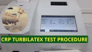 CRP Turbilatex Test Procedure Video  English [upl. by Aleekat]