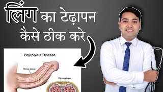 लिंग का टेढ़ापन कैसे दूर करे Best Homeopathic Treatment  Hindi drgajendrarao peyroniesdisease [upl. by Nnylatsyrc171]