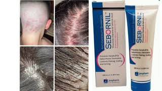 Sebornil anti dandruff shampoo piroctone olamine amp salicylic acid [upl. by Oderfla]