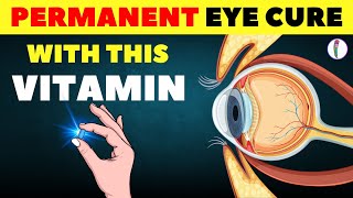 1 Vitamin to Cure Eye Problem Permanently  Eye care Tips  Vitamins eyecare [upl. by Araldo333]