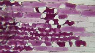 Plasmolysis of Red Onion in Sucrose [upl. by Latsirc]