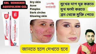 Best Acne Pimple Cream ।। SBL Berberis Aquifolium Gel Benefits ।। Review in Bengali [upl. by Eiralam608]