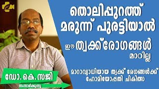 ത്വക്ക് രോഗങ്ങൾ പൂർണ്ണമായും മാറാൻ  treatment for SKIN DISEASE [upl. by Aleacim742]