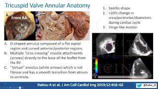 Novel Concepts of Tricuspid Regurgitation Anatomy Pathophysiology and Management [upl. by Ellehcrad]