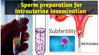 Sperm preparation for iui protocolIntrauterine inseminationSperm preparationSTAR LABORATORY [upl. by Neztnaj]